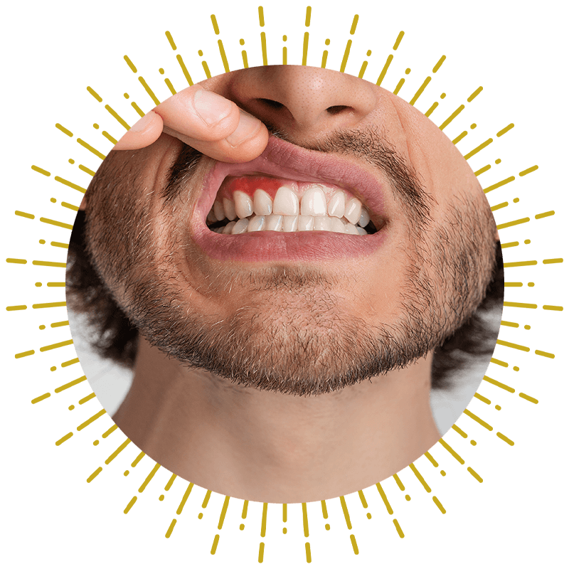 close up of gum issues from person