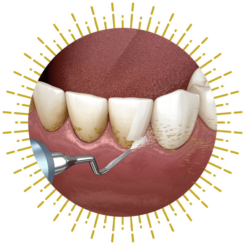 scaling and rooting frame illustration